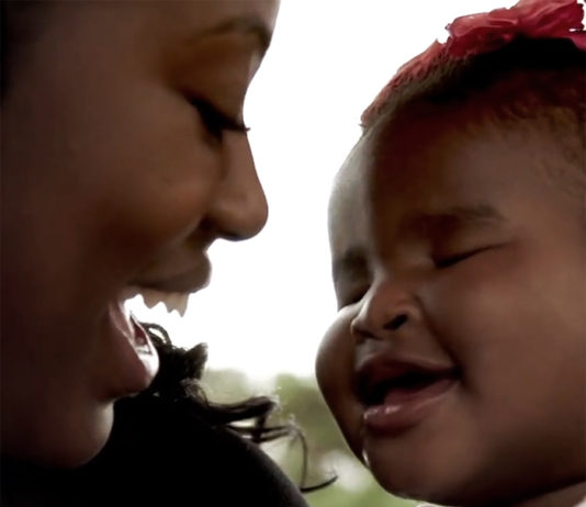 Baby Born Without Eyes!