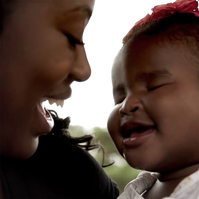 Baby Born Without Eyes!