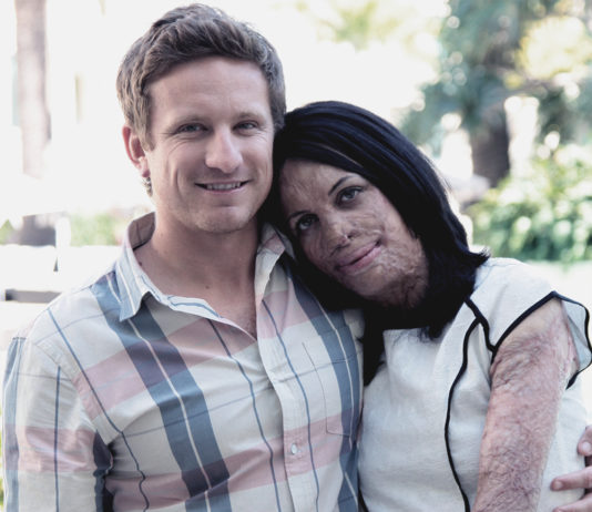 True Love: Ex-Model Turia Pitt